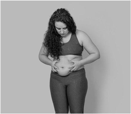 LipoVive  LipoVive  result no.1